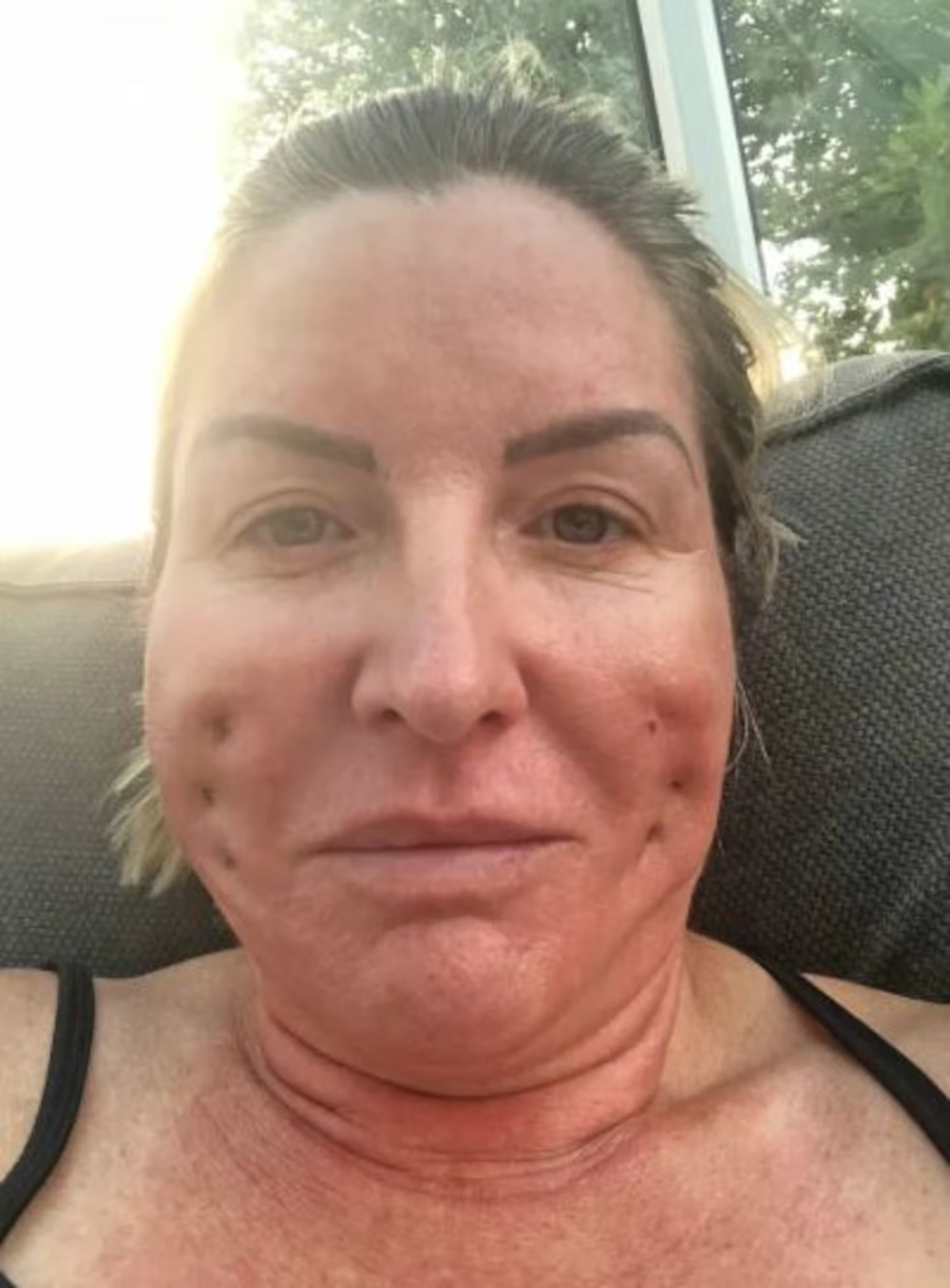 Leigh viajó a Polonia para hacerse un lifting facial y de cuello, que le costó 13.000 libras menos de lo que le hubiera costado en el Reino Unido.