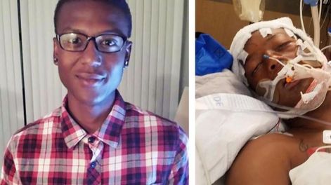Los Andes | Investigan la brutal muerte del joven afroamericano Elijah Mcclain arrestado en 2019 en Denver. Gentileza