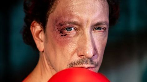 Qué le pasó a Nico Vázquez y por qué suspendió las funciones de Rocky