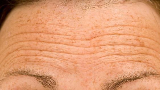 3 alimentos que previenen arrugas, estimulan el colágeno y rejuvenecen la piel, según la ciencia.