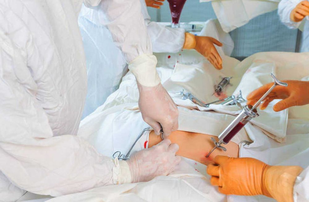 ¿Por qué es importante donar médula ósea?