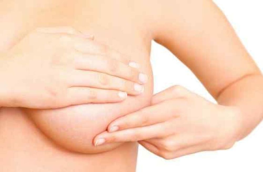 Cáncer de mama. El autoexamen es muy importante para la detección.