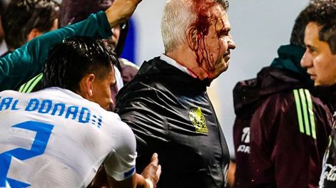 Los Andes | Así quedó Javier Aguirre, DT de la Selección de México, tras ser agredido por un hincha hondureño.