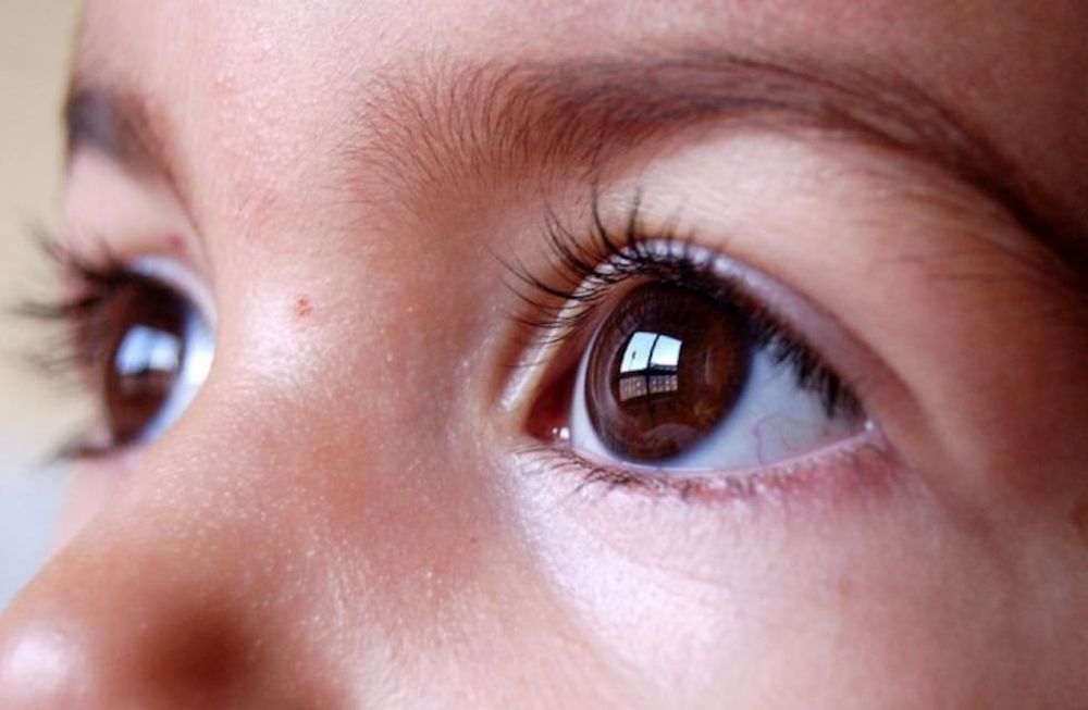 Expertos remarcaron que la exclusión de lácteos, la eliminación de gluten y caseína para niños con autismo o la elección de una alimentación vegana en etapas críticas del desarrollo, pueden derivar en déficits nutricionales Expertos remarcaron que la exclusión de lácteos, la eliminación de gluten y caseína para niños con autismo o la elección de una alimentación vegana en etapas críticas del desarrollo, pueden derivar en déficits nutricionales