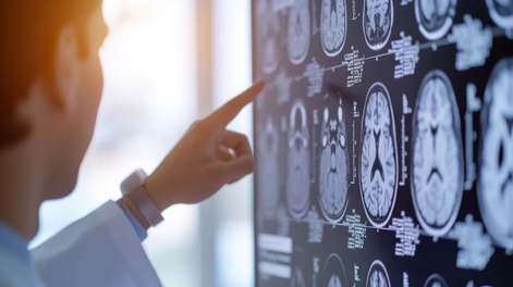 Mendoza recibió una certificación internacional por la forma en que organiza la atención del accidente cerebrovascular (ACV)