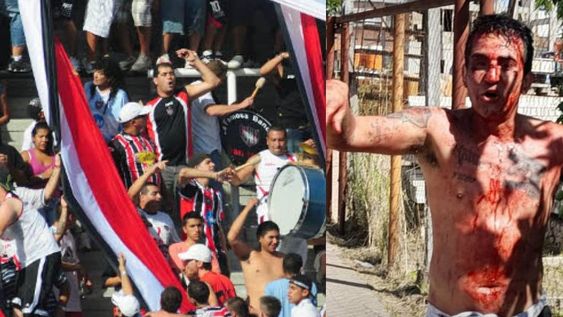 EL LÍDER DE LA BARRA BRAVA DE CHACARITA BAÑADO EN SANGRE TRAS UN ENFRENTAMIENTO. / GENTILEZA.