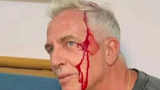 quede chorreando sangre: el accidente de marley en tailandia que genero preocupacion