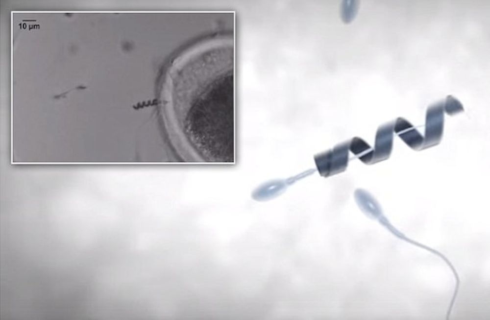 El ‘Spermbot’ podría ser una solución para la astenospermia. Foto: Web
