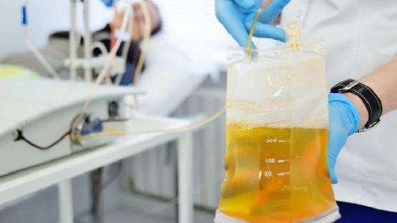 COVID-19: paso a paso, el proyecto local que prevé usar plasma de pacientes recuperados