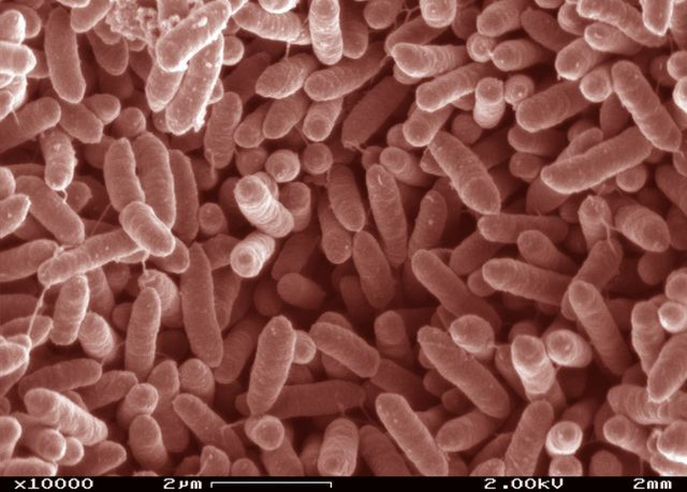 Bacteria Shewanella putrefaciens.