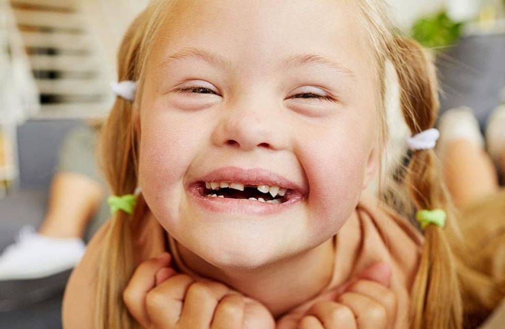 Una adecuada comprensión del síndrome de Down e intervenciones tempranas pueden mejorar la calidad de vida de niños y adultos con este diagnóstico.