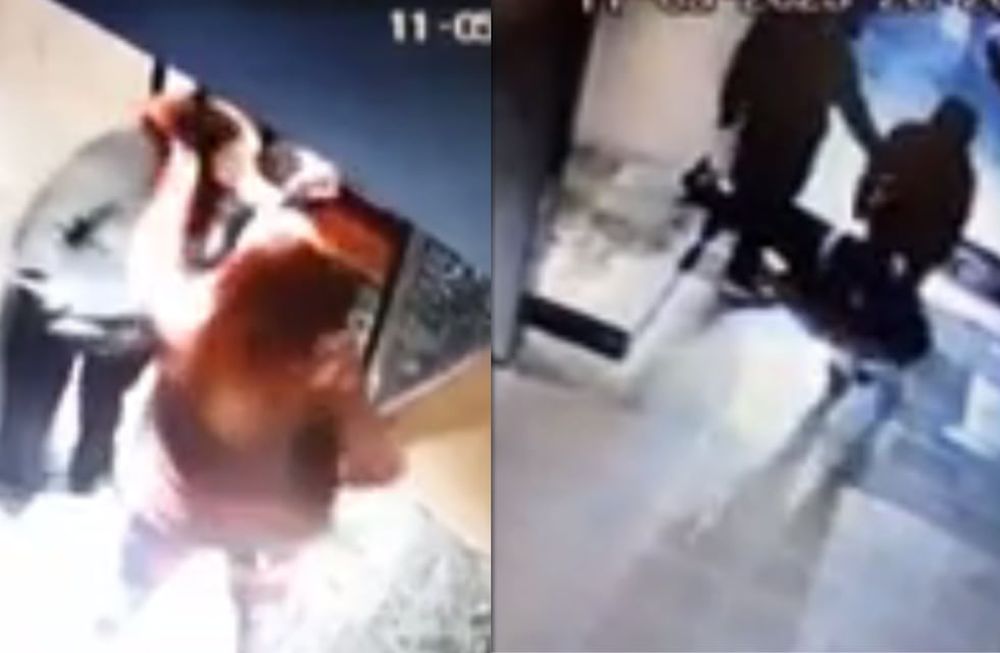 La mujer quedó inconsciente tras caer al piso a causa del golpe que recibió. Además, cuenta con lesiones en las costillas y un moretón en la zona de la frente. Foto: Captura de video