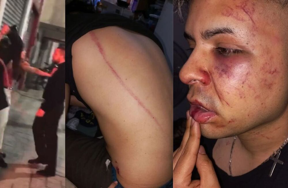 Video: patovicas de un boliche de Tucumán atacaron a latigazos a una pareja y les provocaron graves heridas. / Foto: captura de video / Los Andes