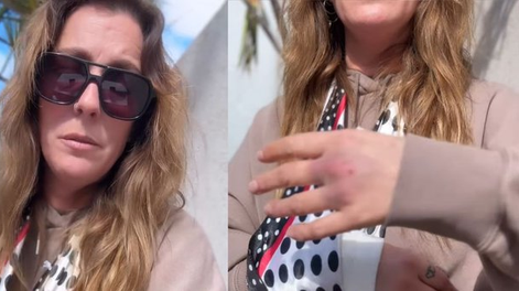 Dani La Chepi terminó herida al separar a su perra de una pelea.