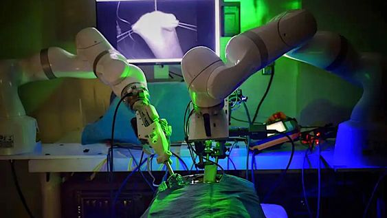 ee.uu: un robot con inteligencia artificial opero por primera vez una vesicula biliar sin intervencion humana