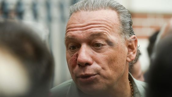 Sergio Berni realizó una polémica comparación respecto a la agresión que recibió. Foto: Clarín