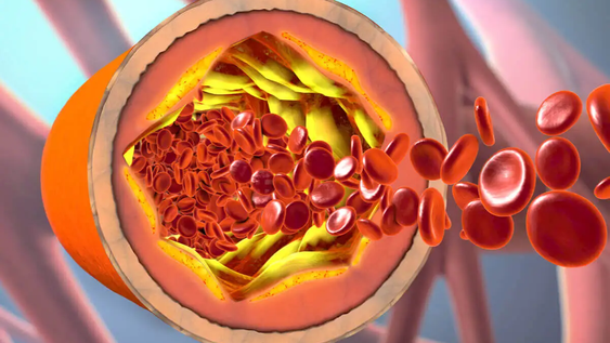 Cuáles son los 3 alimentos que desinflaman arterias y bajan el colesterol.