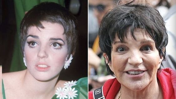 La vida les pasó factura: 13 celebridades que envejecieron mal