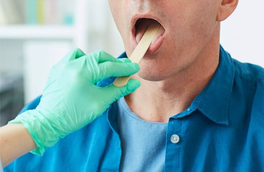 Es producido por varias conductas de riesgo, especialmente por fumar. Pero el sexo oral está teniendo que ver también en el aumento de casos, según especialistas.