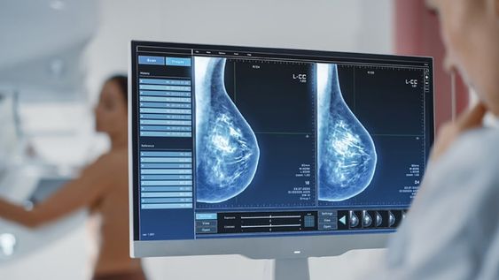 ¿Por qué es importante preservar la salud en las mujeres?