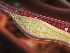 3 alimentos que limpian las arterias y regulan la presión arterial