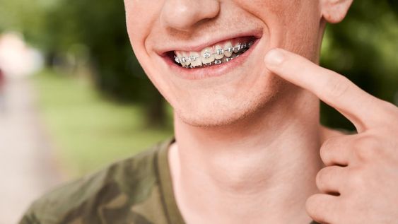 Sonrisas en armonía: la clave de una ortodoncia efectiva