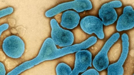 Virus de Marburgo