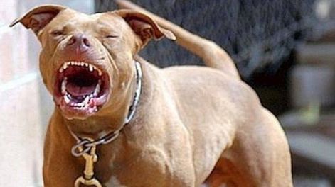 Los Andes | Pitbull atacó a niño de 9 meses