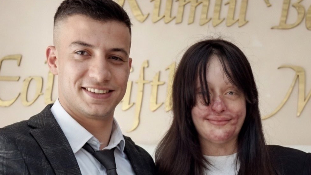 Su novio le arrojó ácido y le desfiguró la cara, ella lo perdonó y se casaron