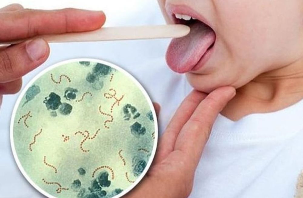Cuáles son los síntomas del Streptococcus pyogenes