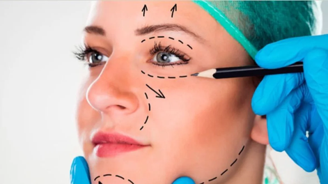 Cada vez más mujeres menores de 40 años se someten a cirugías faciales.