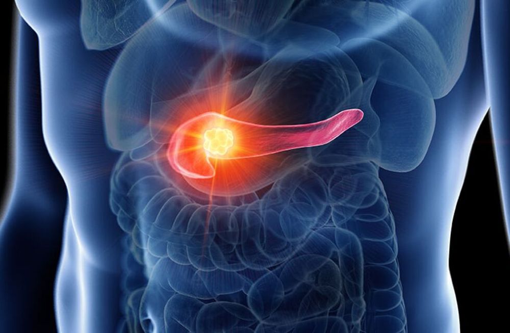 España: lograron eliminar el cáncer de páncreas en ratones con la combinación de tres fármacos