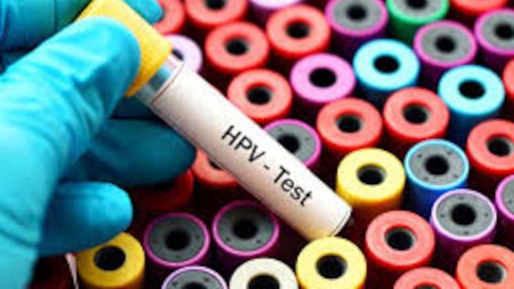 Test para detectar el Virus del Papiloma Humano