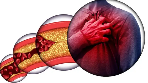 Según la ciencia, cuál es el fruto seco que limpia las arterias y protege el corazón
