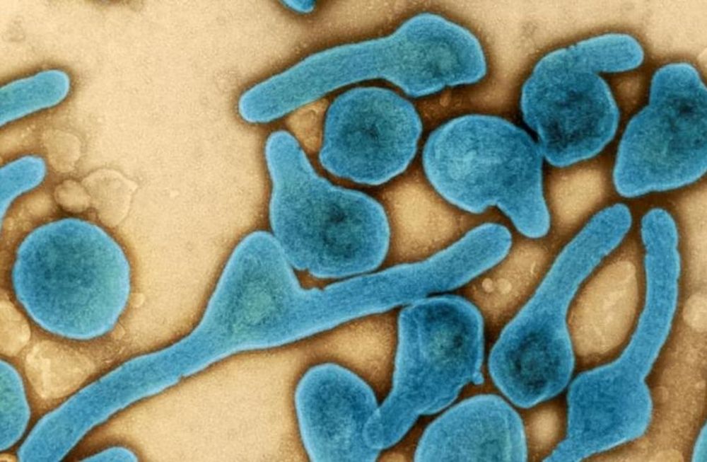 Virus de Marburgo