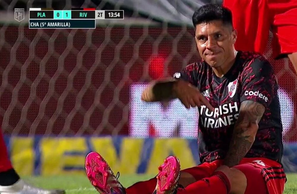 Señala su codo luxado.