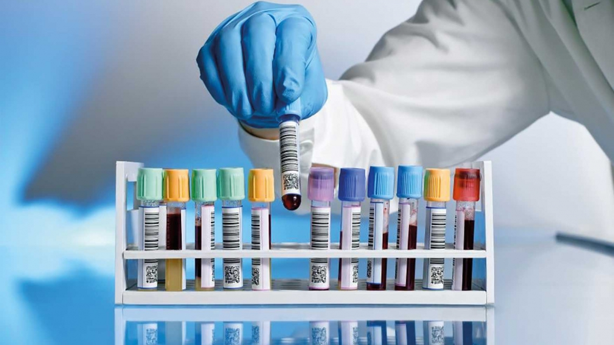 Cómo interpretar los resultados de los análisis de sangre: ¿es bueno usar la inteligencia artificial?