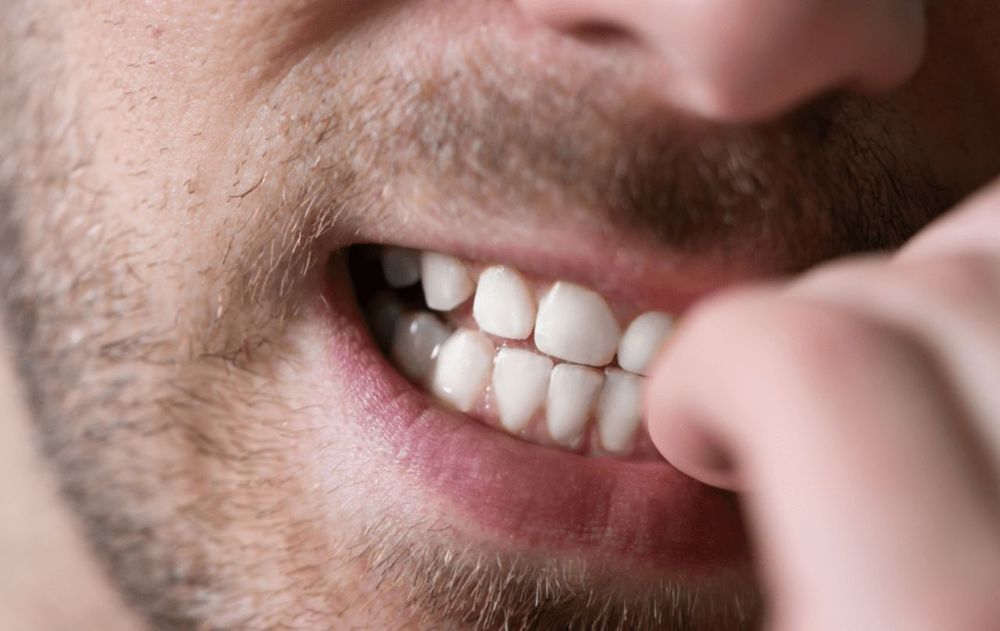 No es nerviosismo: qué significa morderse las uñas todo el tiempo ...