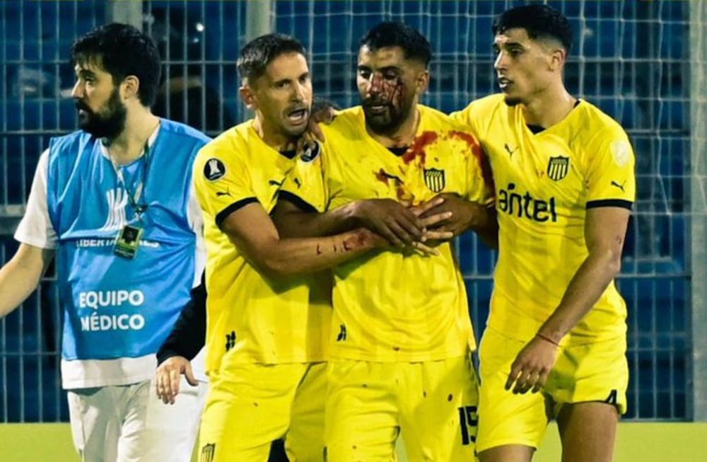 Maxi Olivera, el jugador de Peñarol que fue agredido en el campo de juego del Gigante de Arroyito. (Captura).