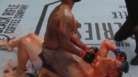 Artes marciales mixtas: violento y sangriento KO en la UFC