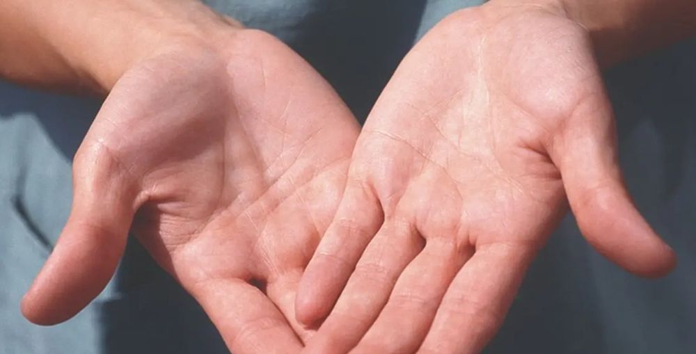 This change usually affects both hands, causing redness of the skin around the nail.