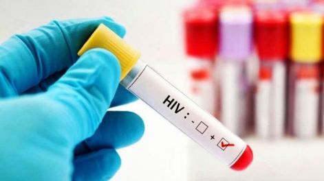 El VIH en la agenda global - Por Pedro Cahn