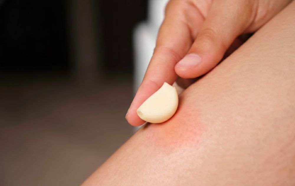 El ajo es una opción práctica para una acción rápida ante las picaduras de mosquitos.