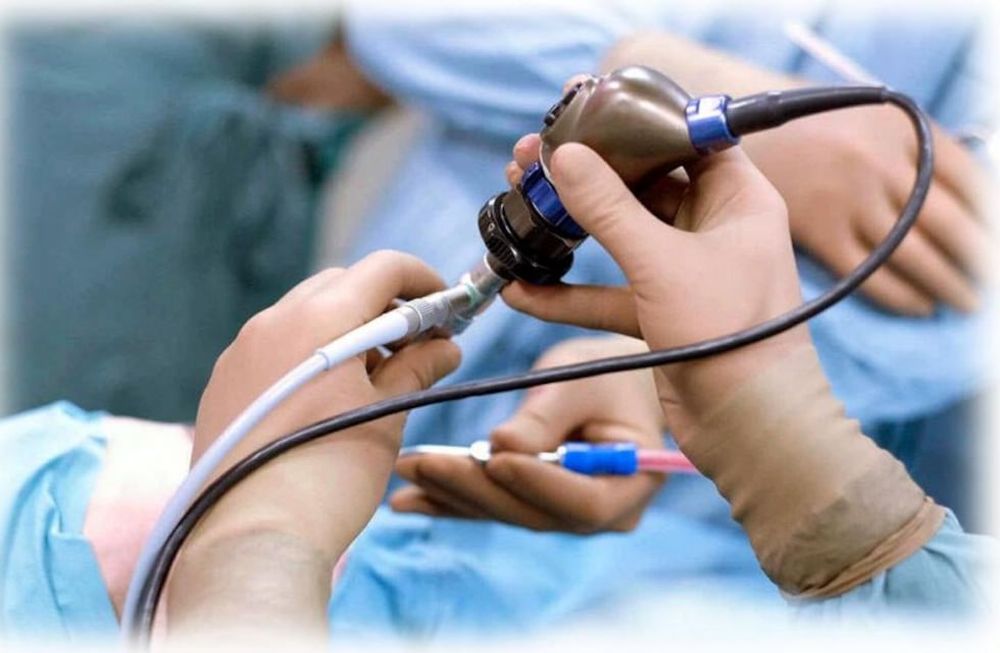 Cáncer de colon: consiguen facilitar la detección