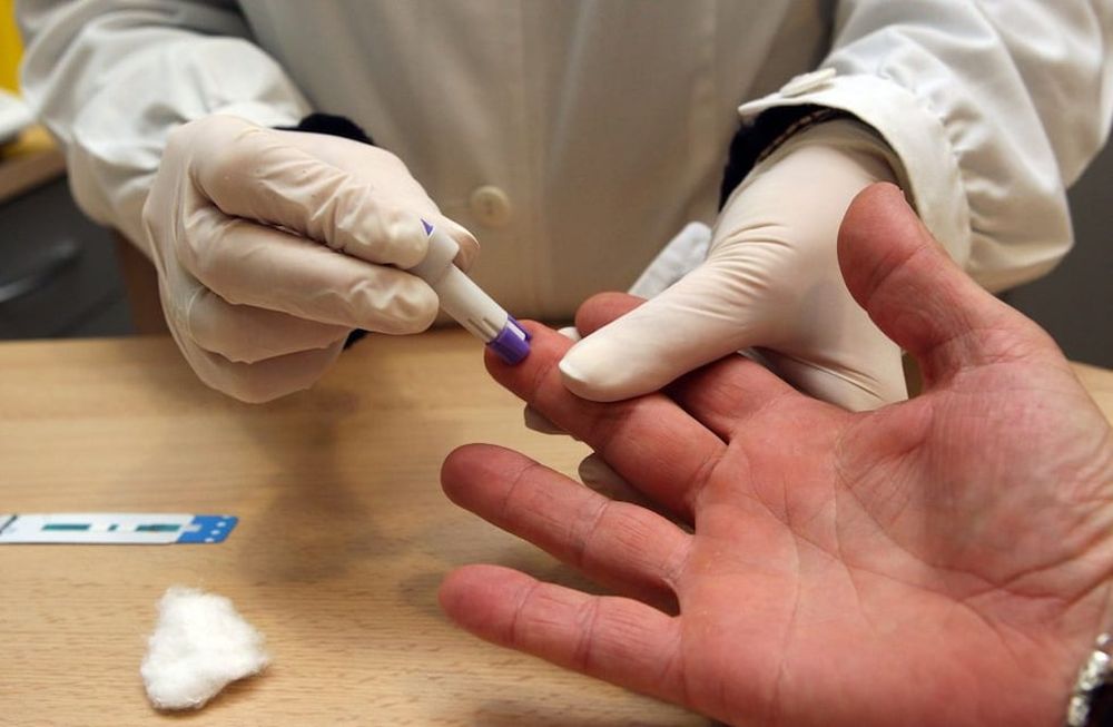 Preocupa la reducción de testeos de VIH en un 40%, producto de la cuarentena