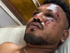 Ramesh Vishwakumar, pasajero sobreviviente de la tragedia de Air India