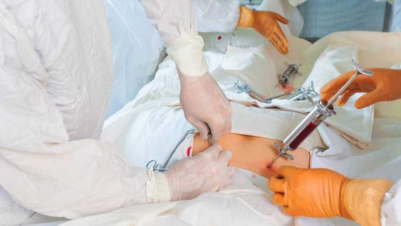 ¿Por qué es importante donar médula ósea?