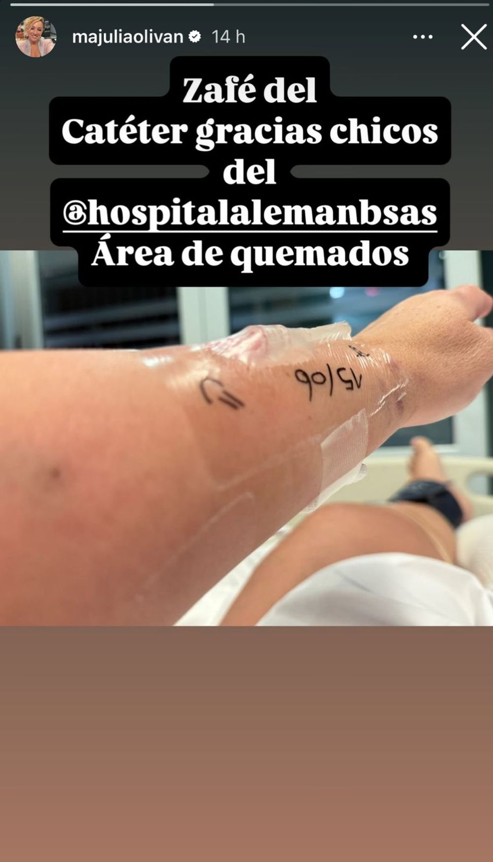 Por qué María Julia Oliván está en terapia intensiva: su estado de salud