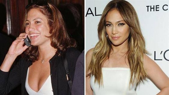 Top 5: ellas dicen que no se operaron, ¿será cierto?