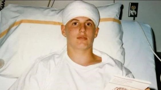 El estadounidense Jeff Henigson cuando tenía solo 15 años y había sido falsamente diagnosticado con cáncer de cerebro. Foto: Gentileza
